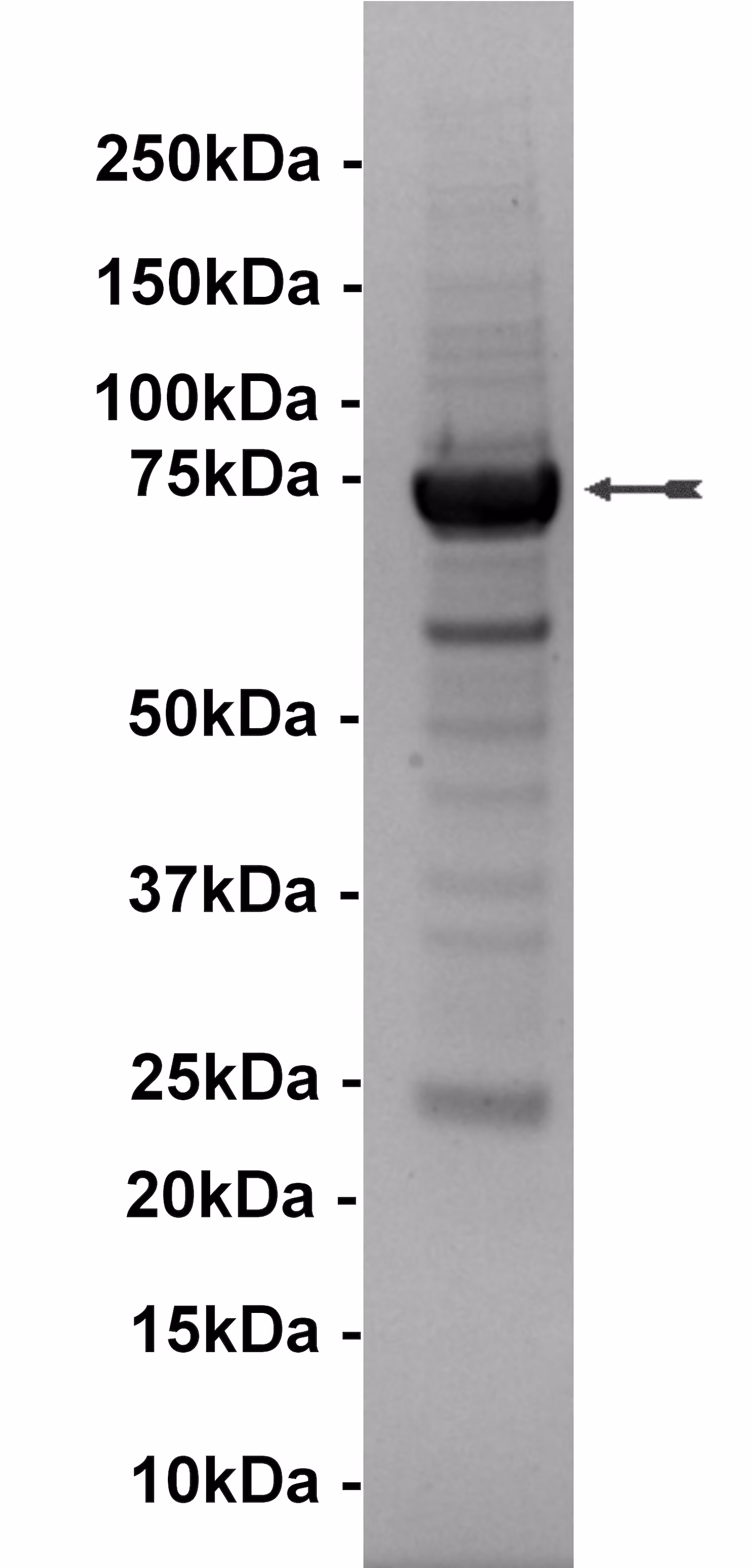 Bmx, active Human Recombinant Kinase Protein