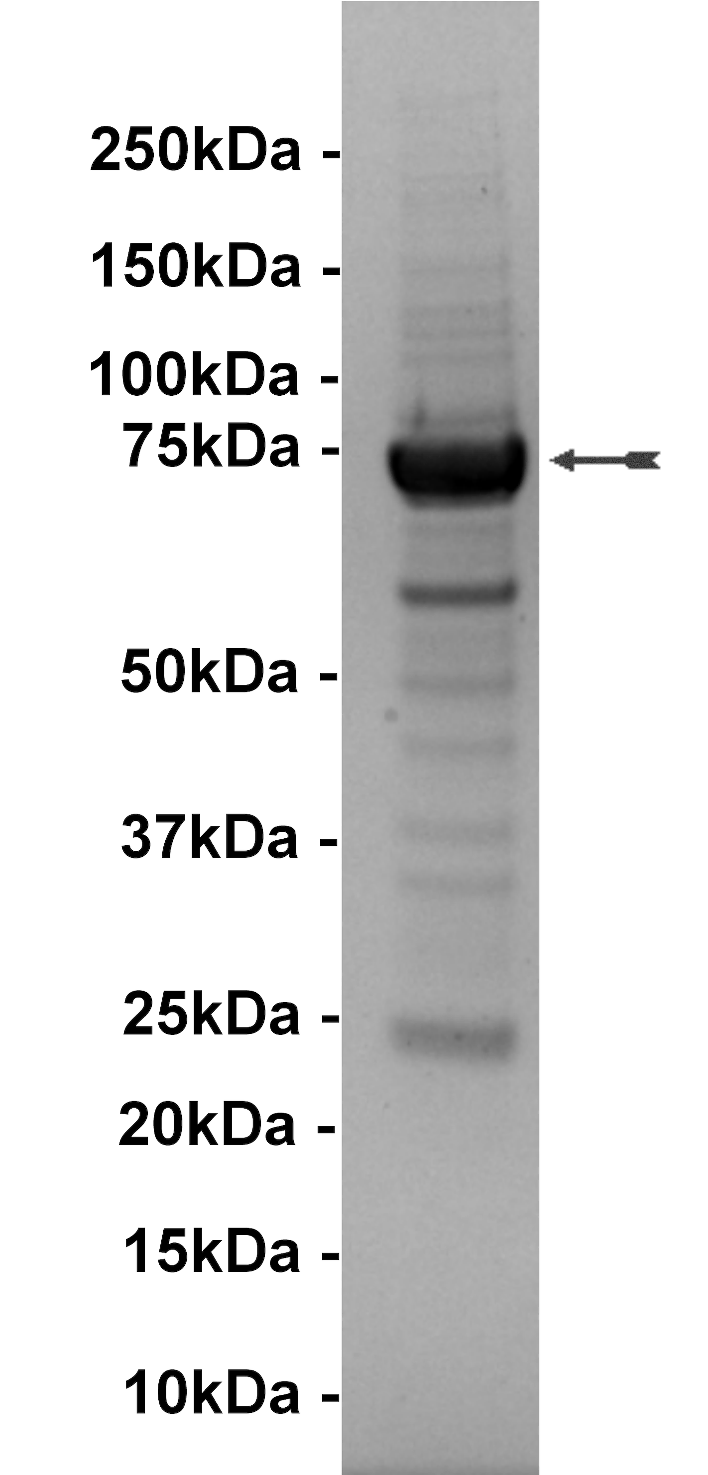 Bmx, active Human Recombinant Kinase Protein