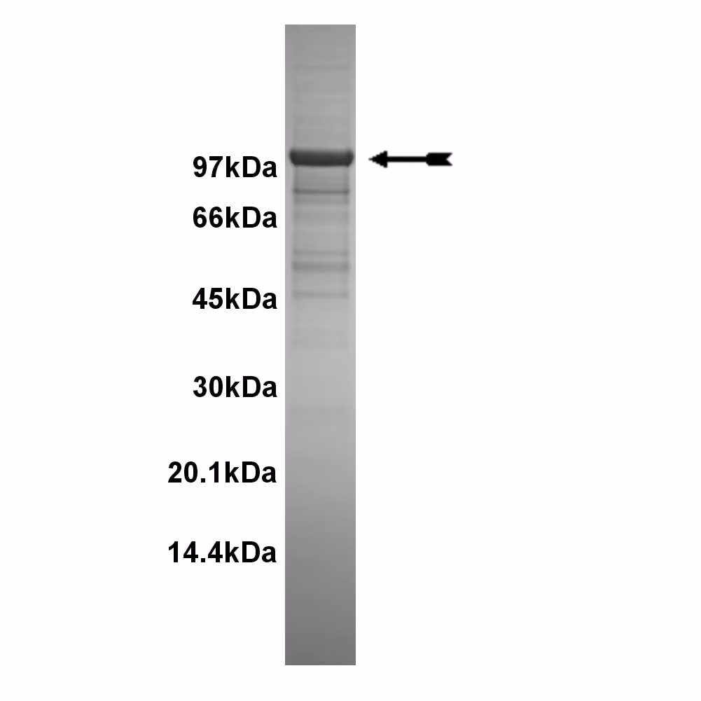 PKD2, active Human Recombinant Kinase Protein