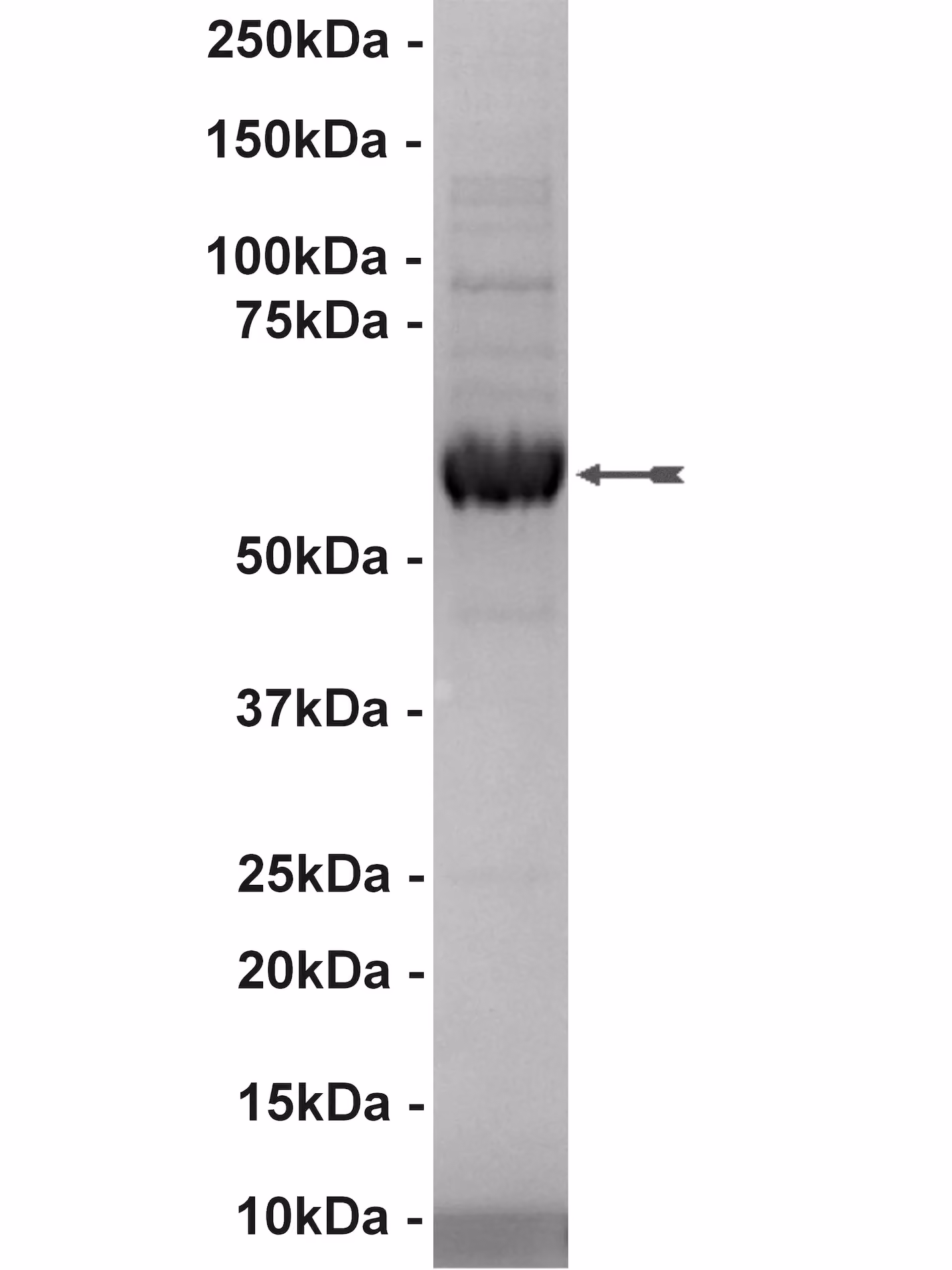 Lyn, active Human Recombinant Kinase Protein
