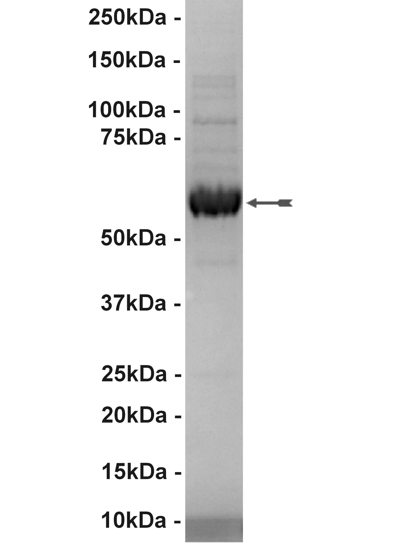 Lyn, active Human Recombinant Kinase Protein