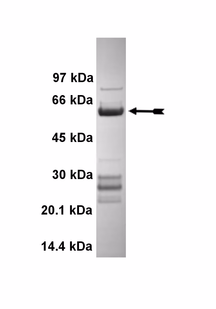 Casein Kinase 1δ (aa 1-294), active Human Recombinant Kinase Protein