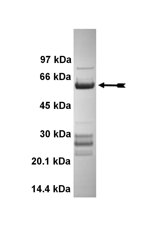 Casein Kinase 1δ (aa 1-294), active Human Recombinant Kinase Protein