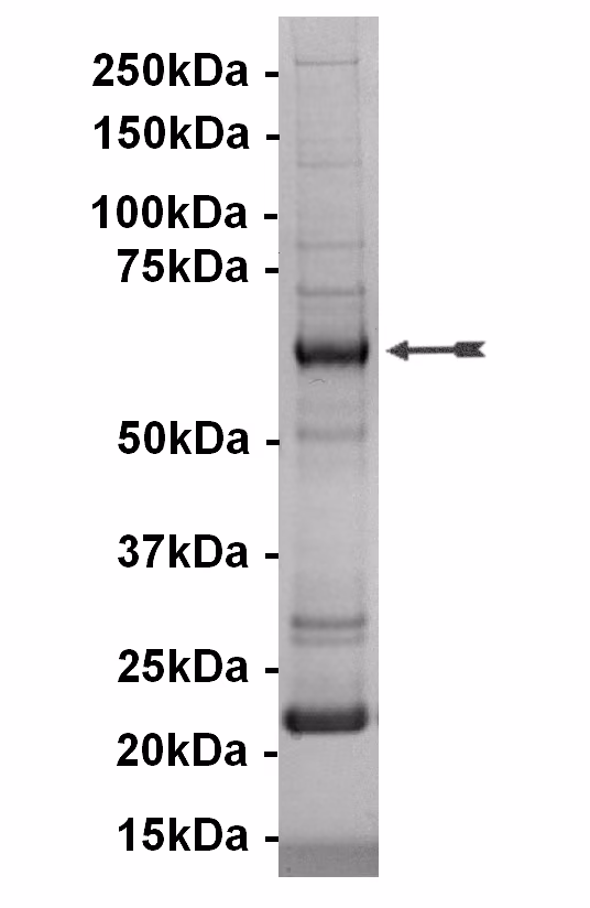 B-Raf (δ1-415), active Human Recombinant Kinase Protein