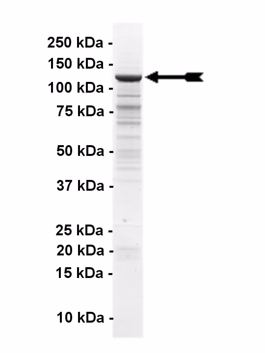 Abl, active Human Recombinant Kinase Protein