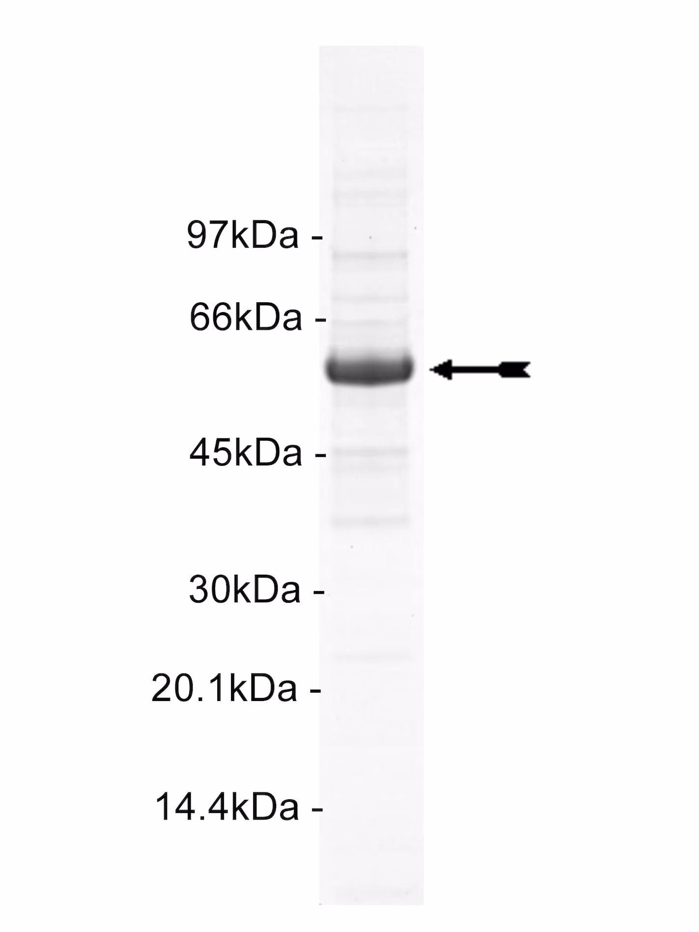 MST2, active Human Recombinant Kinase Protein