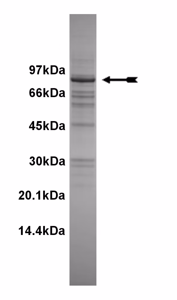 PAR-1Bα, active Human Recombinant Kinase Protein