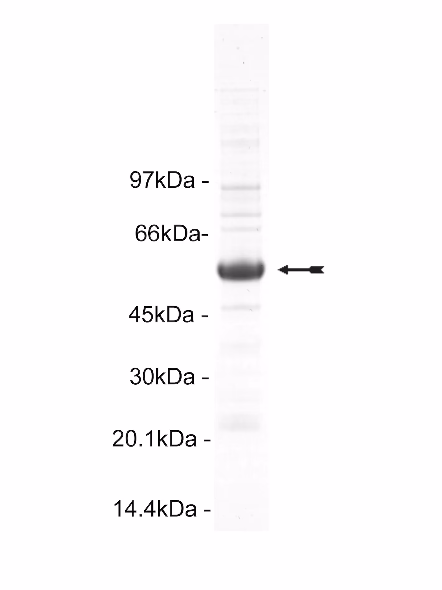 CaM Kinase IV, active Human Recombinant Kinase Protein