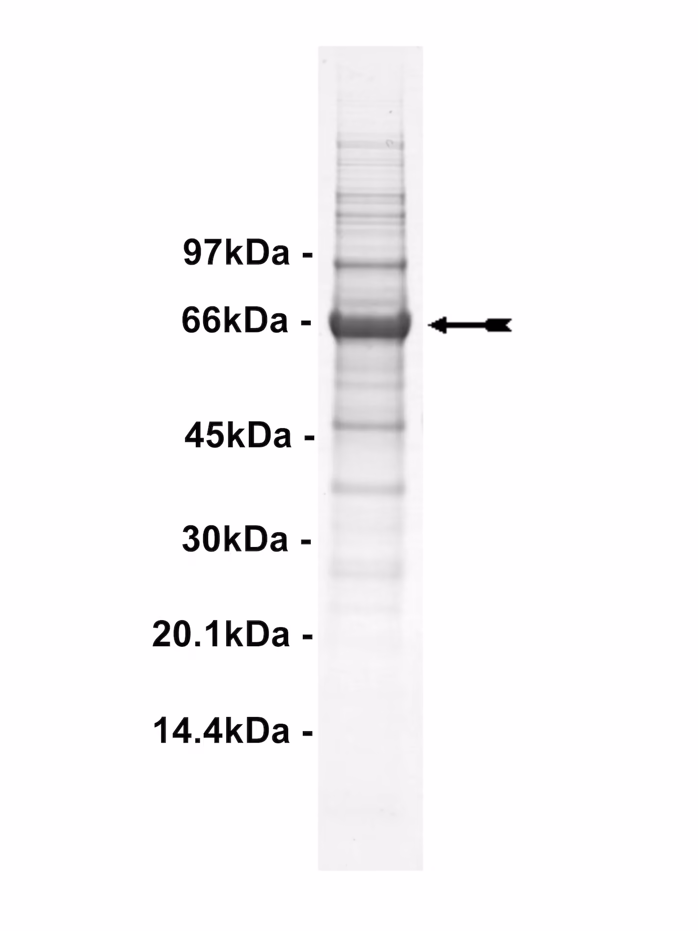 PRK2, active Human Recombinant Kinase Protein