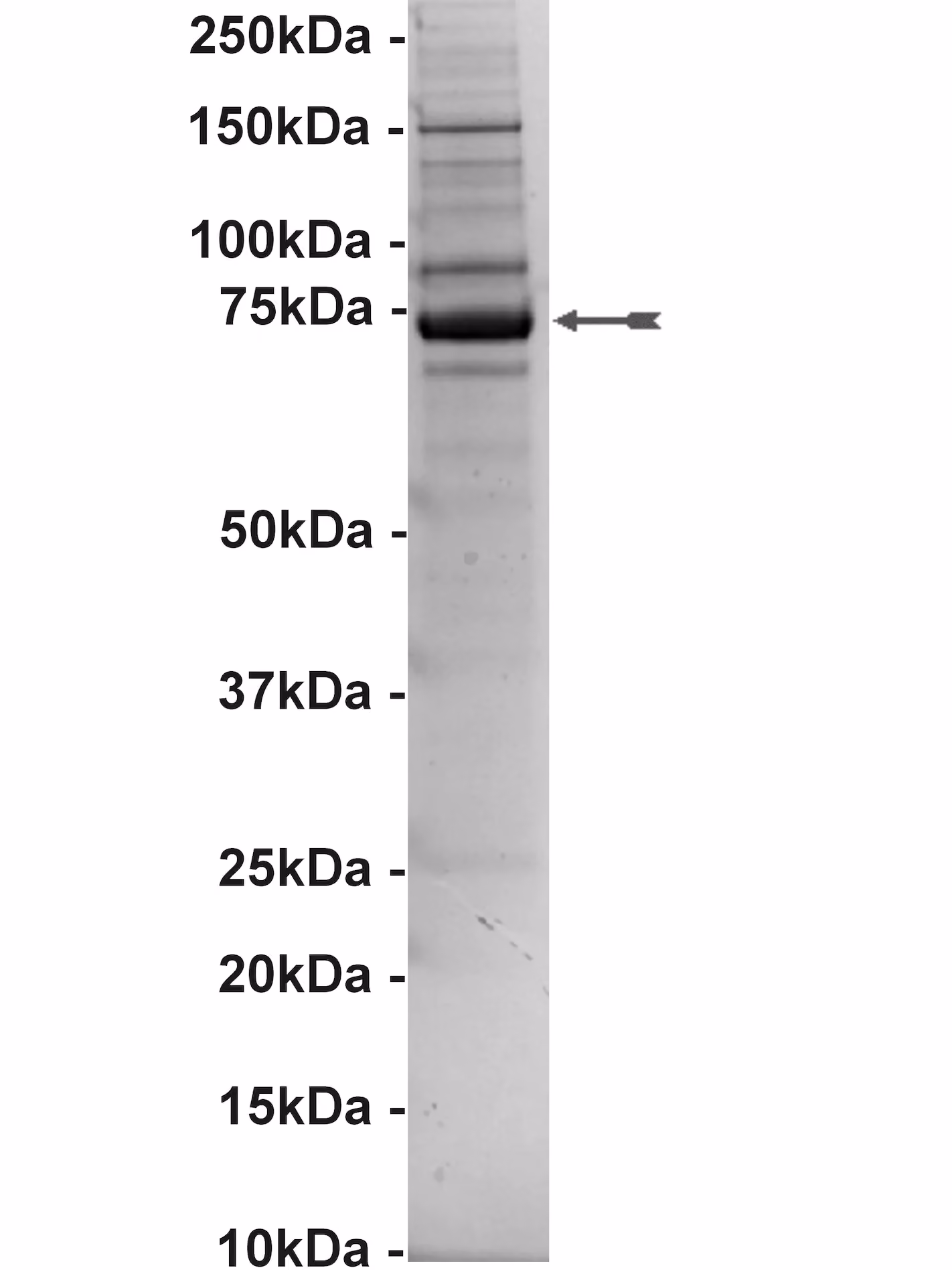 BTK, active Human Recombinant Kinase Protein