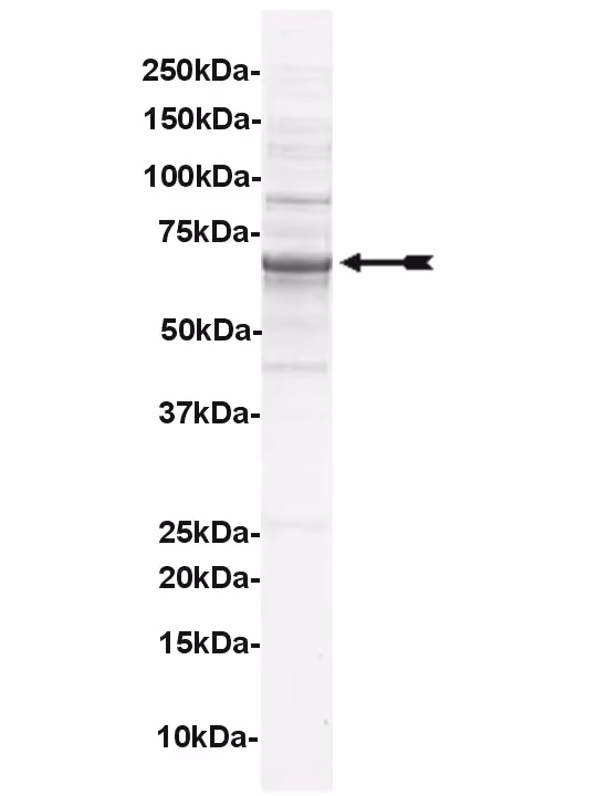 Alk, active Human Recombinant Kinase Protein