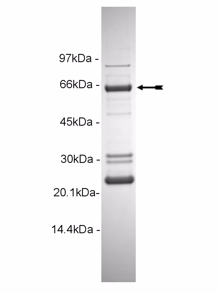 B-Raf (V599E), active Human Recombinant Kinase Protein