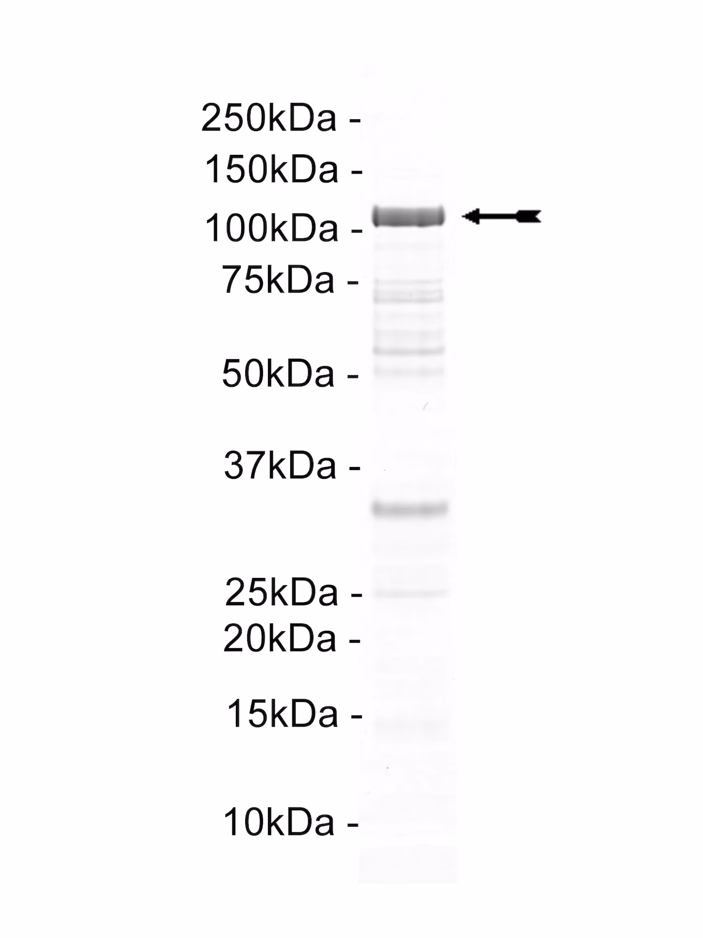 SRPK1, active Human Recombinant Kinase Protein