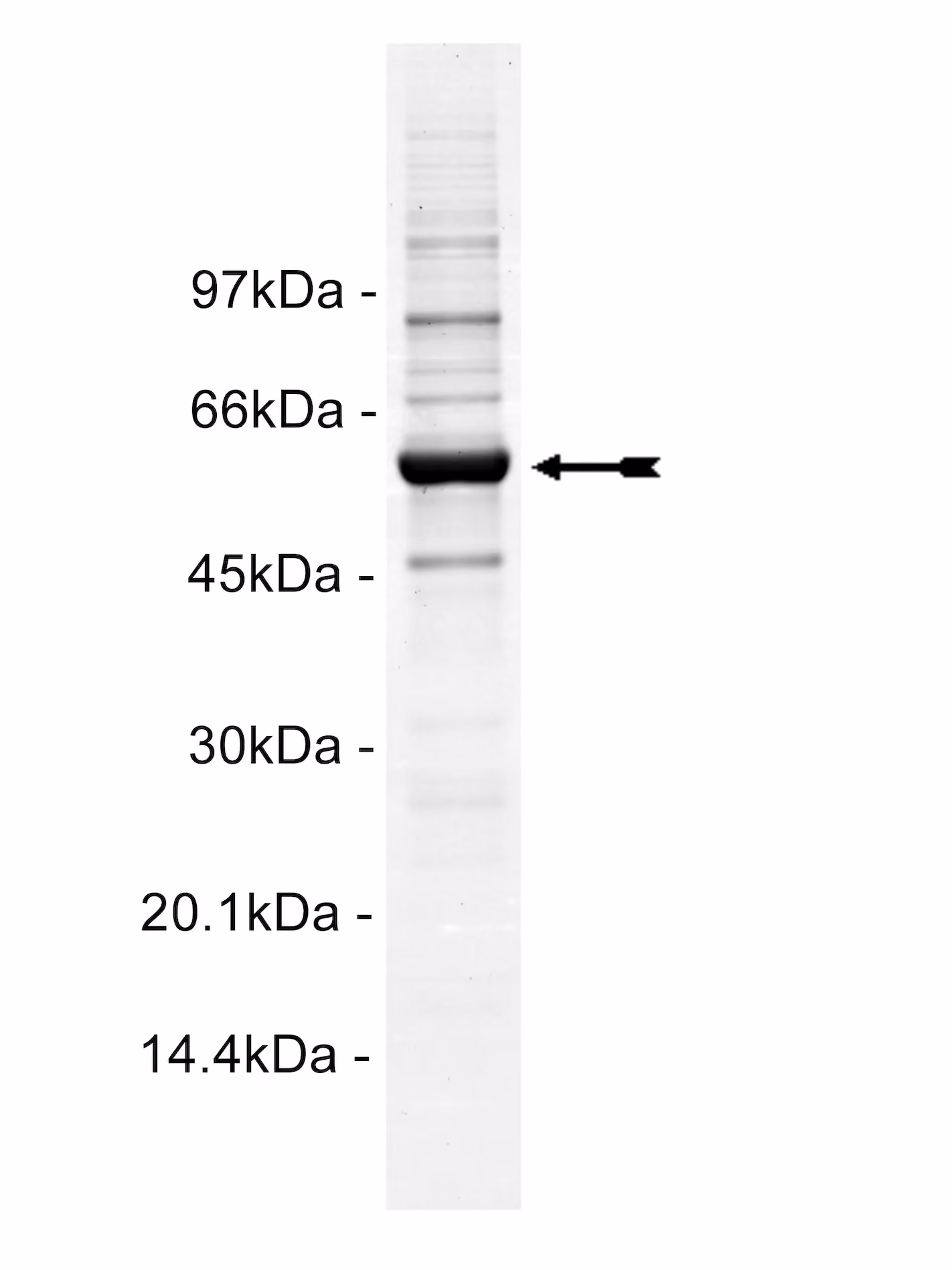 Fgr, active Human Recombinant Kinase Protein