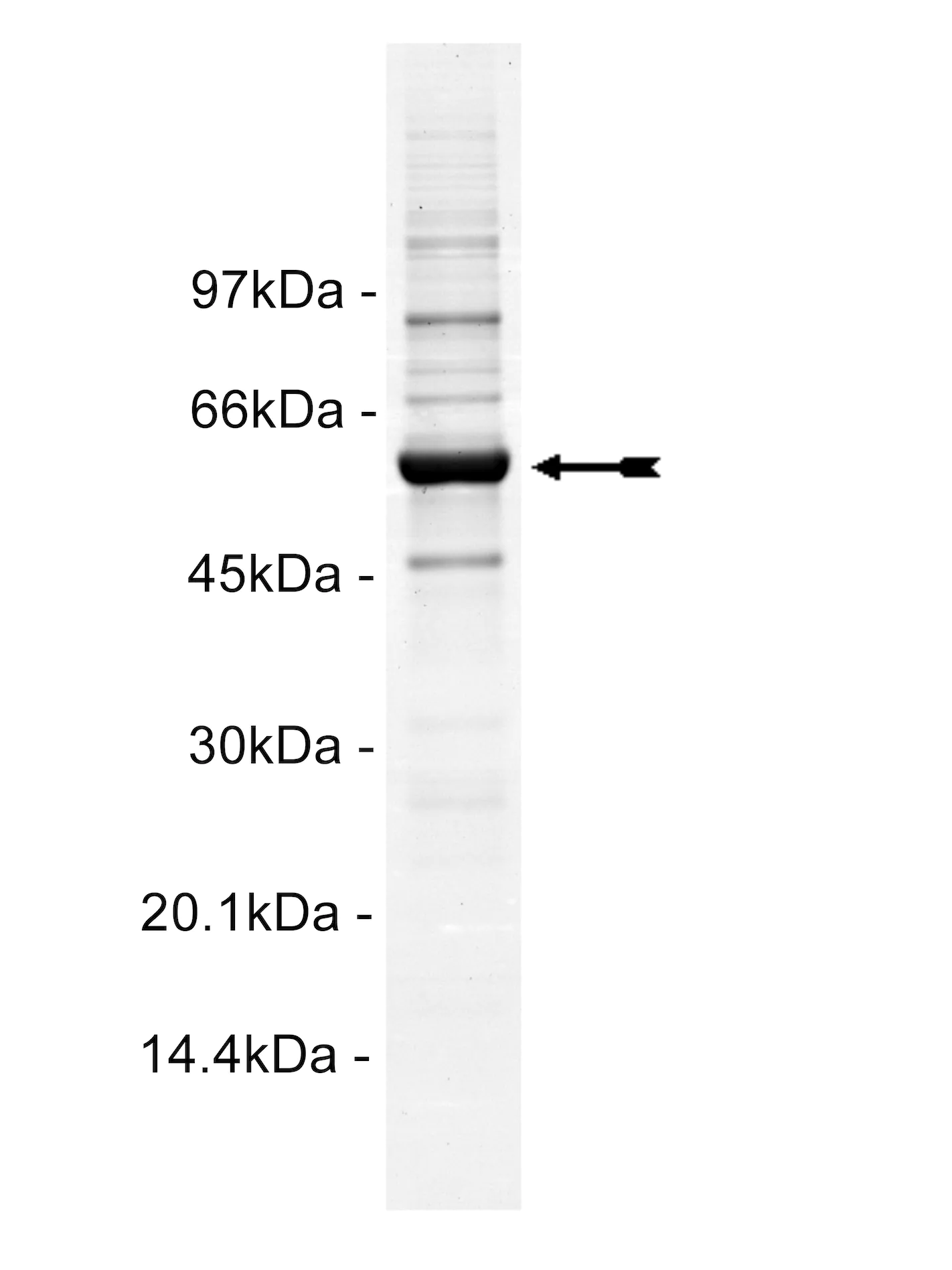 Fgr, active Human Recombinant Kinase Protein