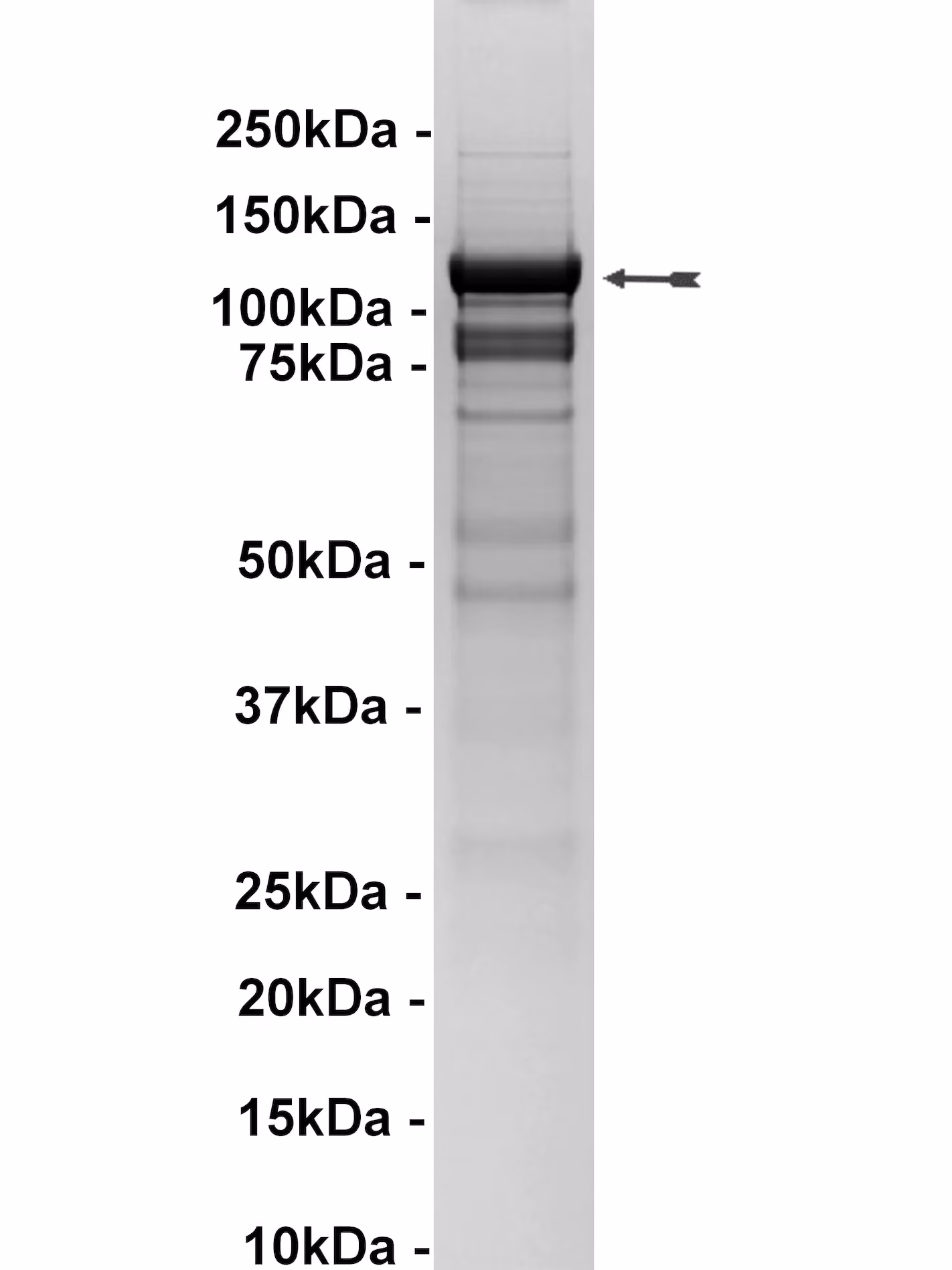 Pyk2, active Human Recombinant Kinase Protein