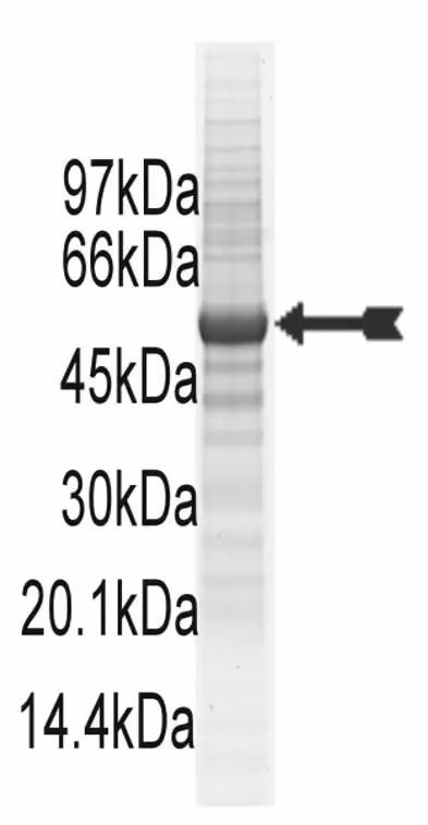 MRCKβ, active Human Recombinant Kinase Protein