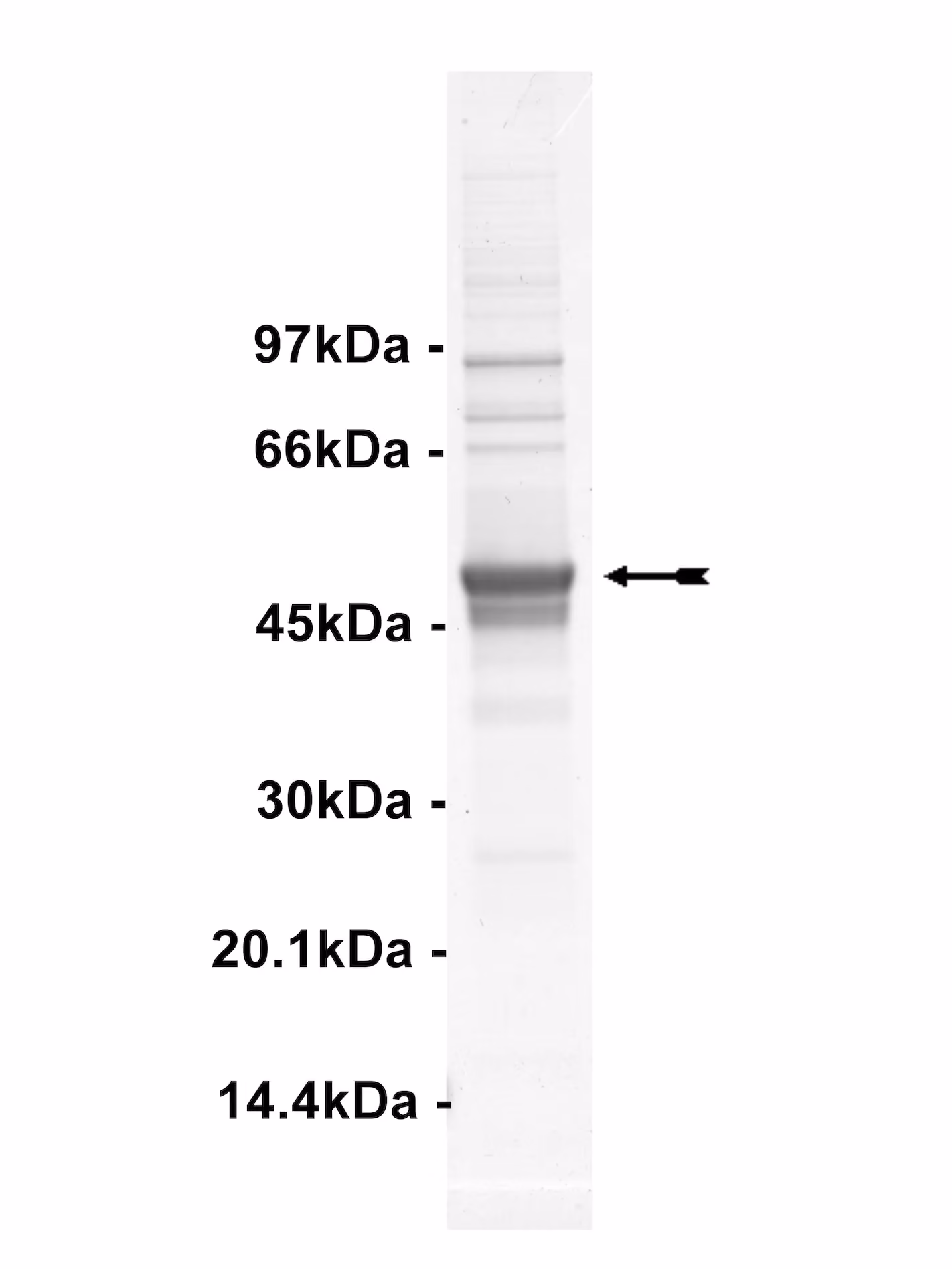 DDR2, active Human Recombinant Kinase Protein