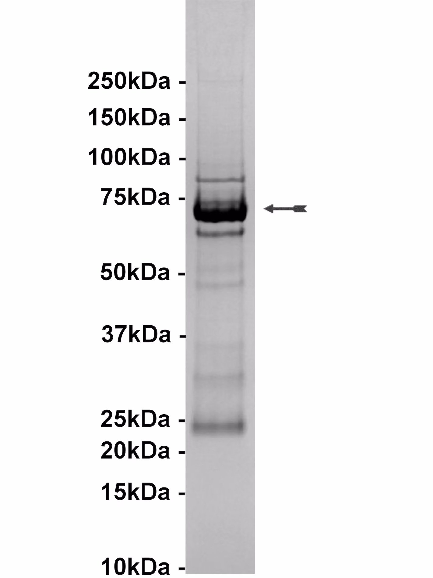 Ron, active Human Recombinant Kinase Protein