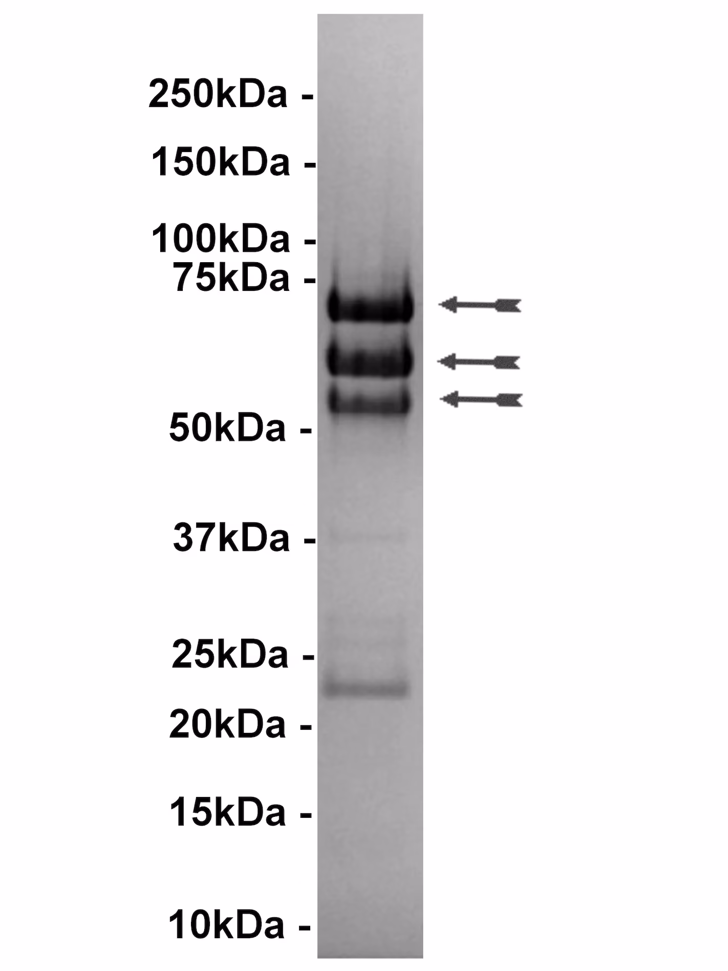 LKB1/STRADα/MO25α, active Human Recombinant Kinase Protein