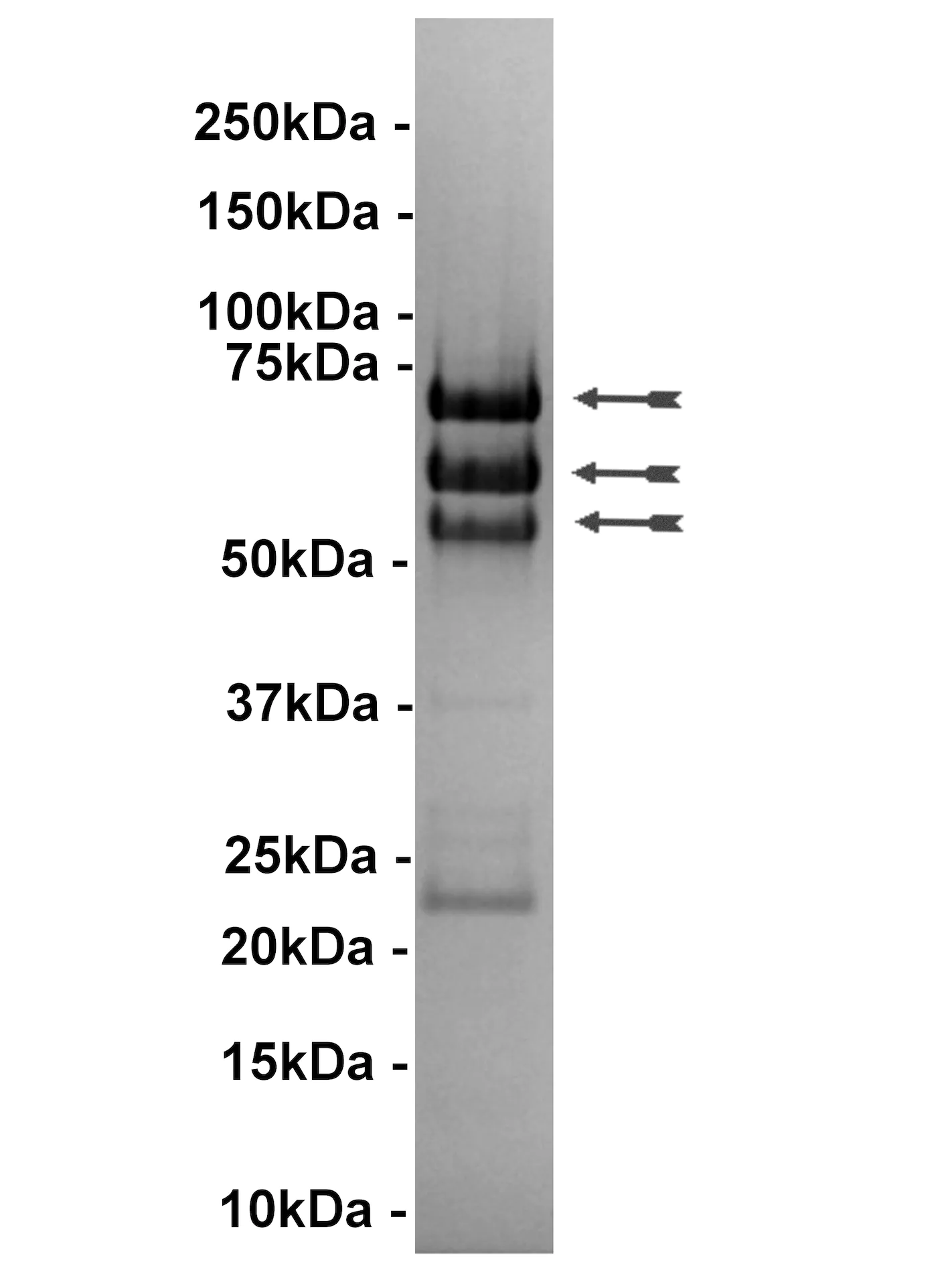 LKB1/STRADα/MO25α, active Human Recombinant Kinase Protein