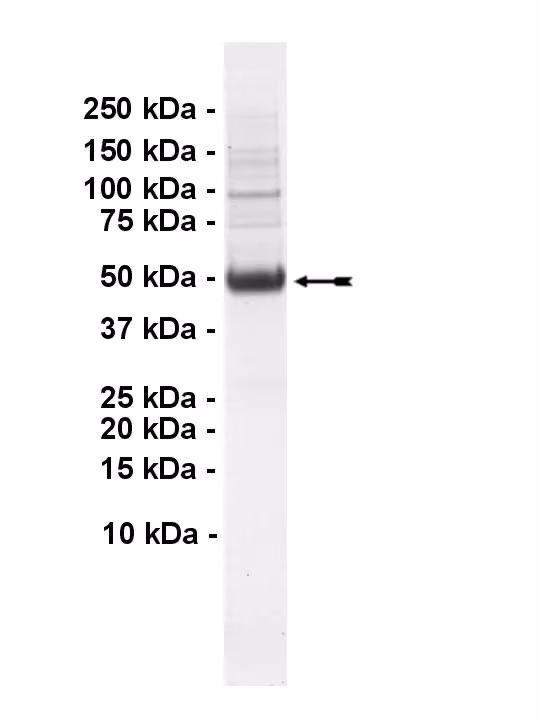 TAK1-TAB1 FUSION, active Human Recombinant Kinase Protein