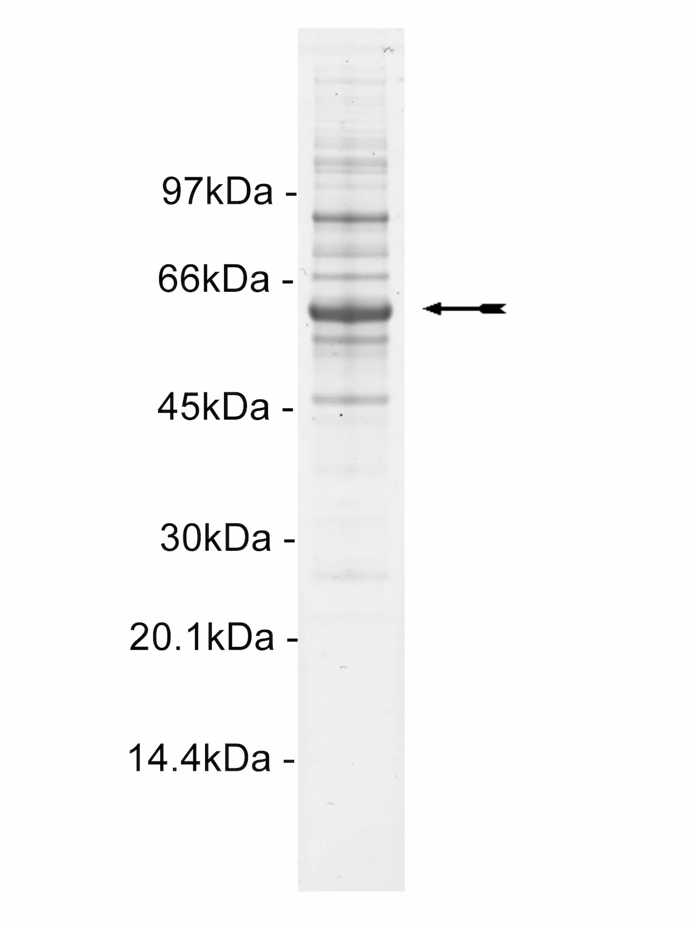 ROKβ/ROCK-I, active Human Recombinant Kinase Protein
