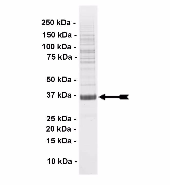 Fer, active Human Recombinant Kinase Protein