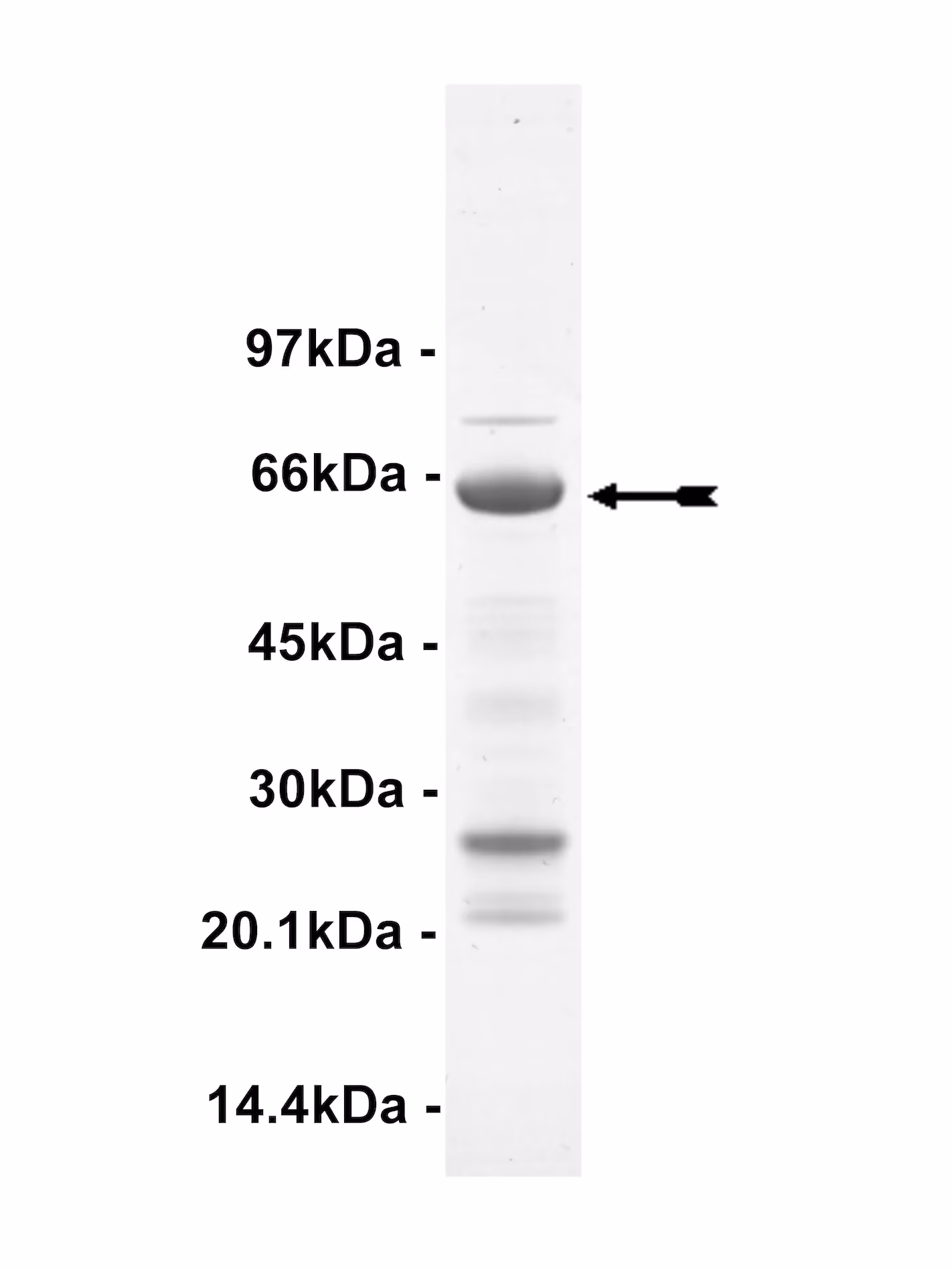 ZIPK, active Human Recombinant Kinase Protein