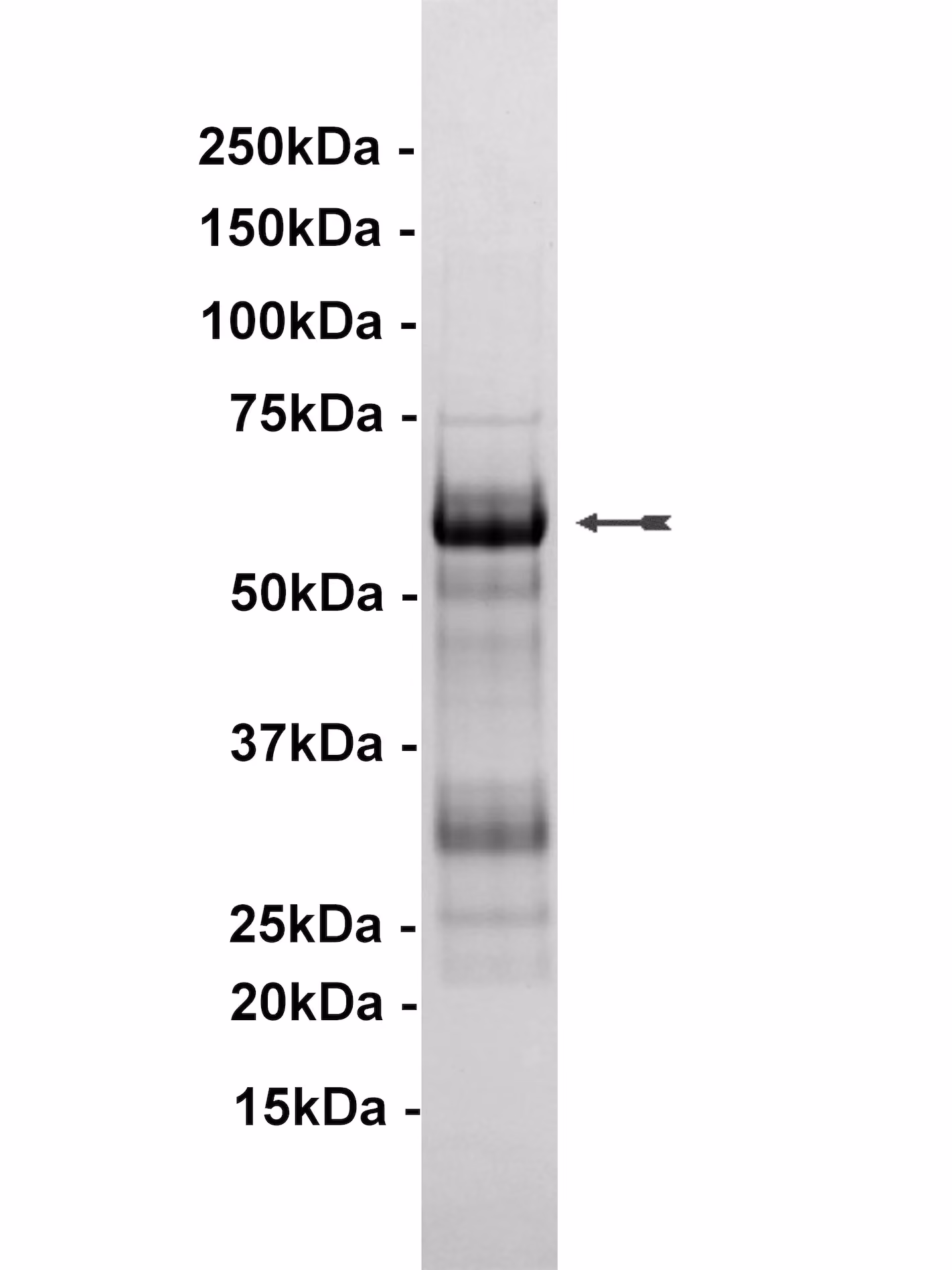 PIM2, active Human Recombinant Kinase Protein
