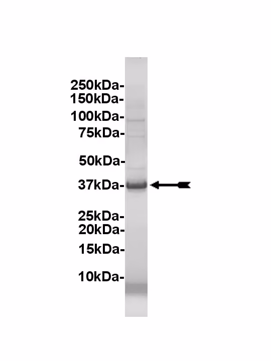 RIPK2, active Human Recombinant Kinase Protein