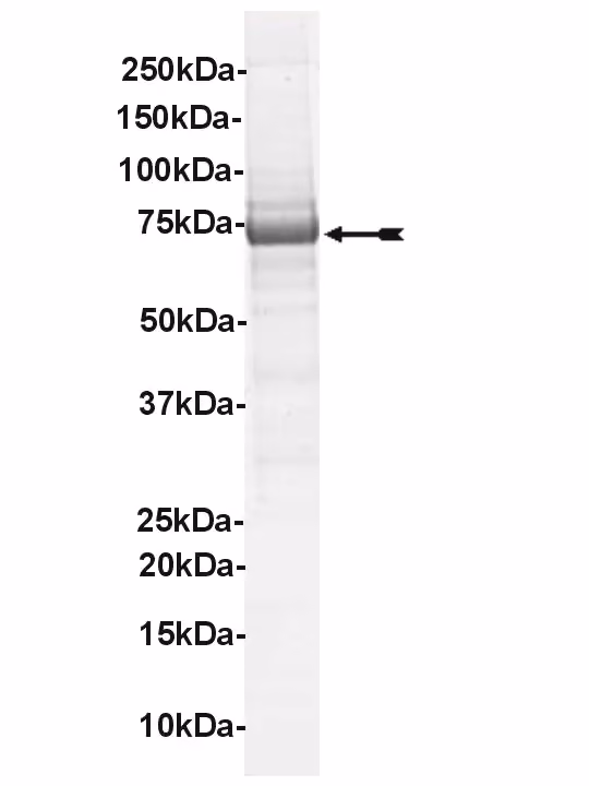 c-Kit (D816V), active Human Recombinant Kinase Protein