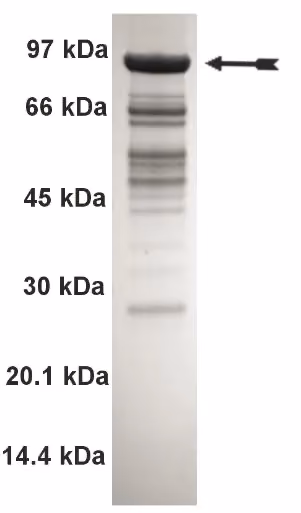 BrSK1, active Human Recombinant Kinase Protein