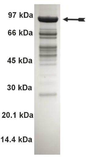 BrSK1, active Human Recombinant Kinase Protein