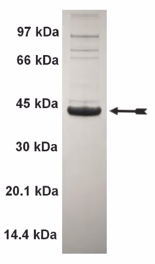 WNK2, active Human Recombinant Kinase Protein