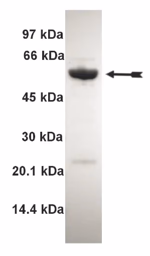MST3, active Human Recombinant Kinase Protein