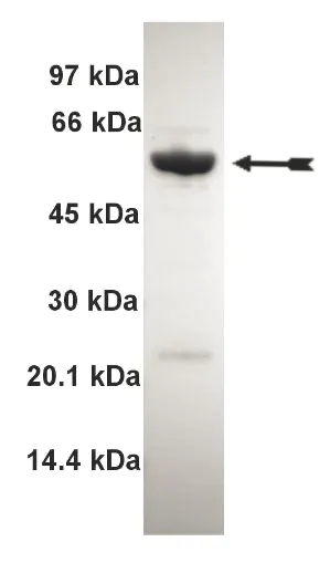 MST3, active Human Recombinant Kinase Protein