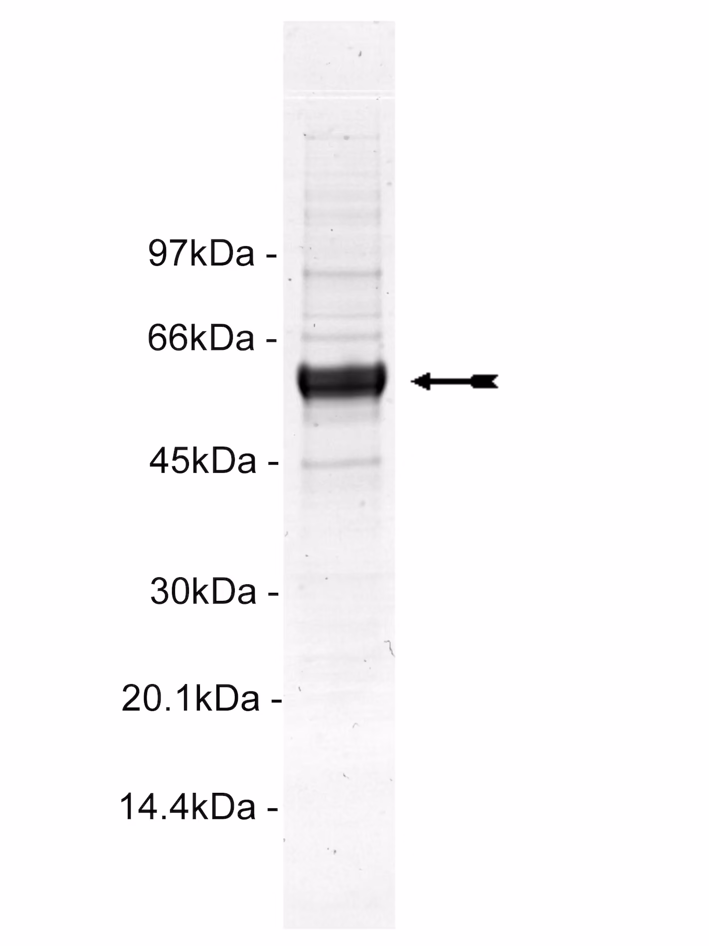 MST1, active Human Recombinant Kinase Protein