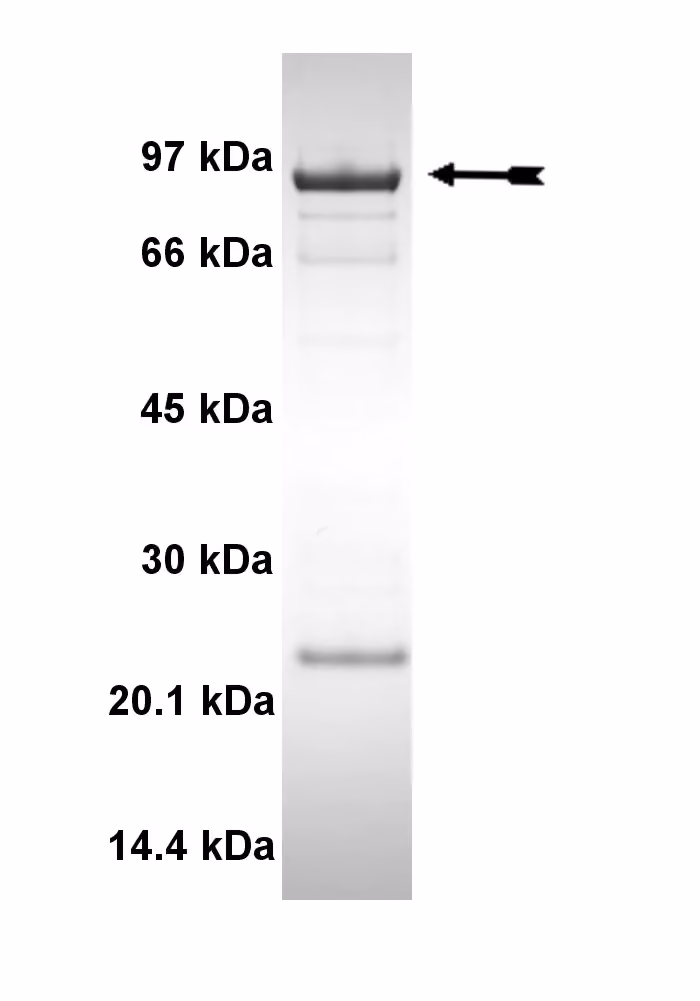 EGFR (L858R), active Human Recombinant Kinase Protein