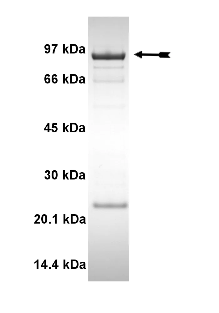 EGFR (L858R), active Human Recombinant Kinase Protein