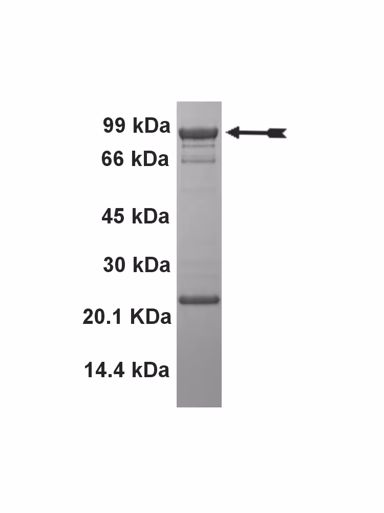 EGFR (L861Q), active Human Recombinant Kinase Protein