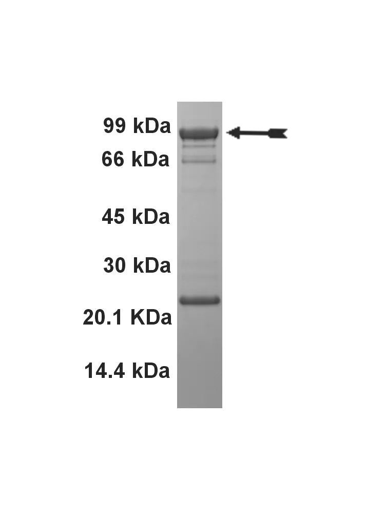 EGFR (L861Q), active Human Recombinant Kinase Protein