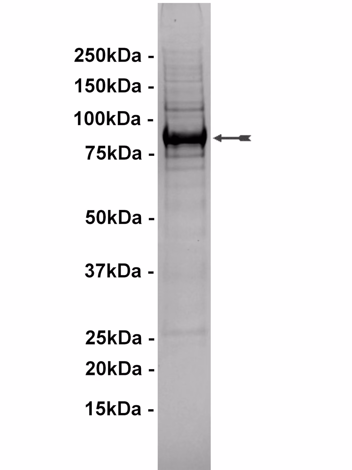TBK1, active Human Recombinant Kinase Protein