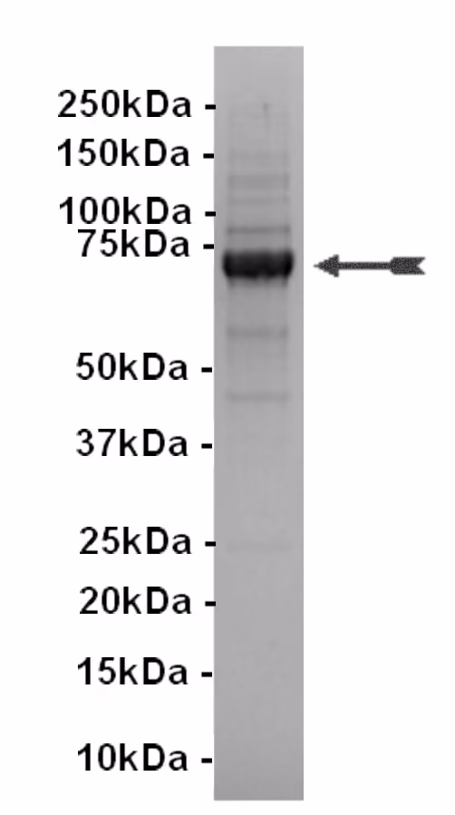 KDR, active Human Recombinant Kinase Protein