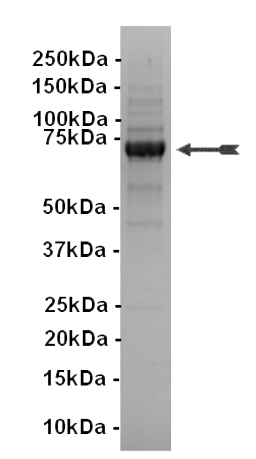 KDR, active Human Recombinant Kinase Protein