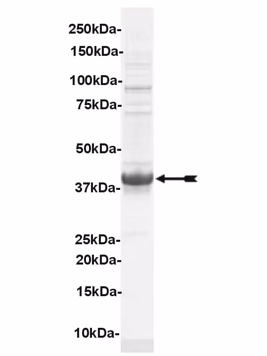 MuSK, active Human Recombinant Kinase Protein