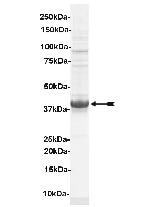 MuSK, active Human Recombinant Kinase Protein