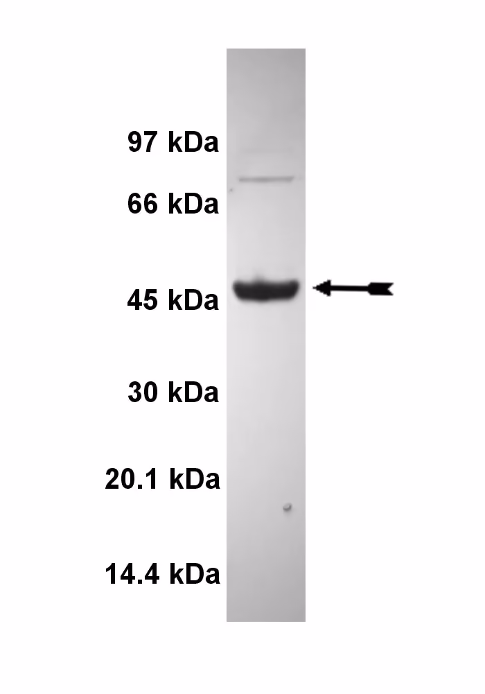 MLCK, active Human Recombinant Kinase Protein
