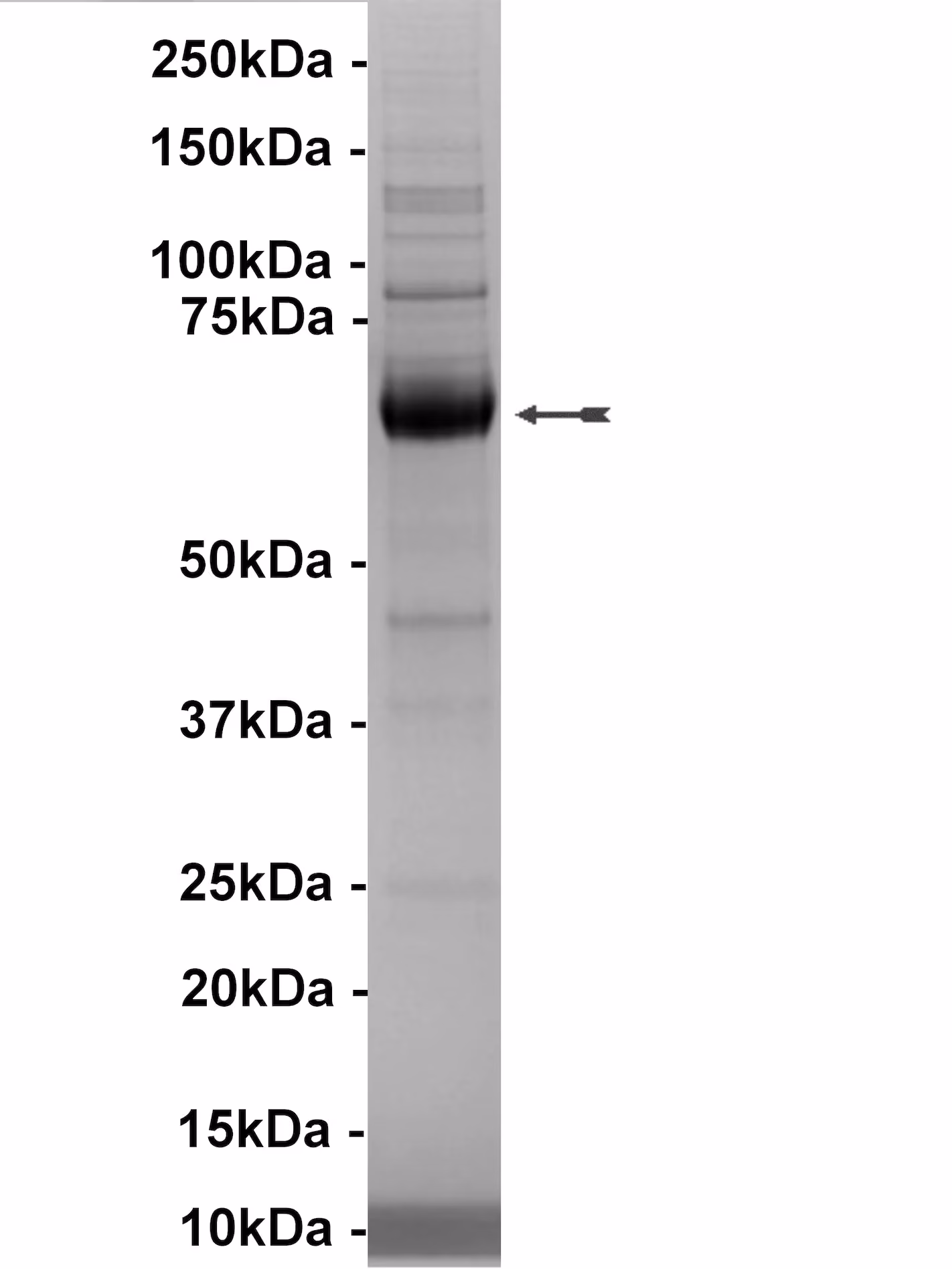DMPK, active Human Recombinant Kinase Protein