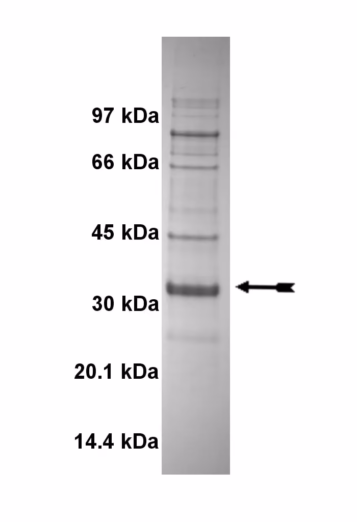 SIK, active Human Recombinant Kinase Protein